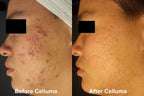 Celluma PRO