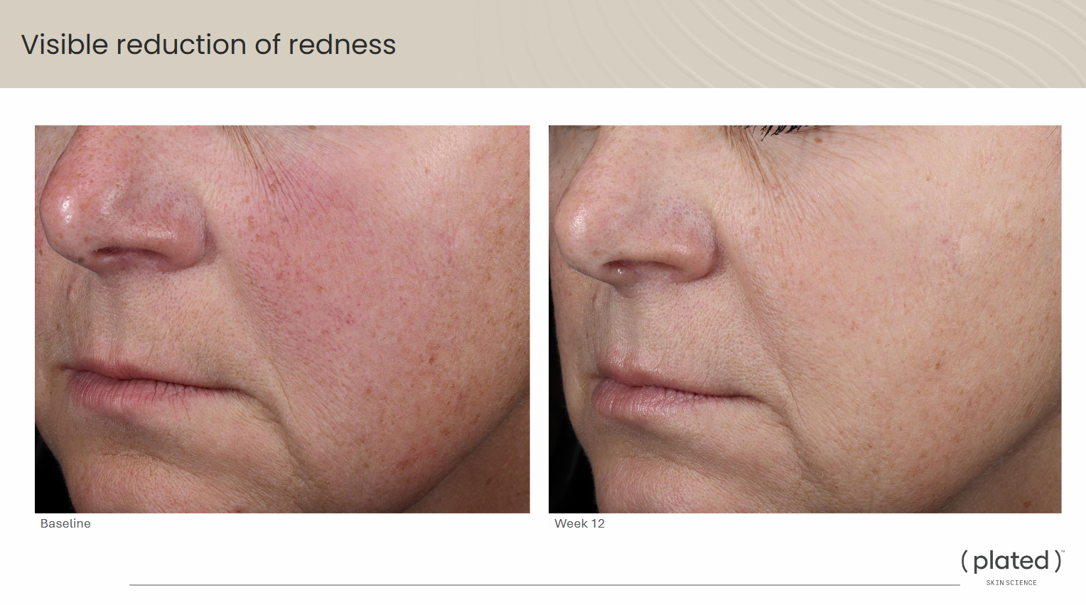 ( plated )™ Skin Science INTENSE Serum
