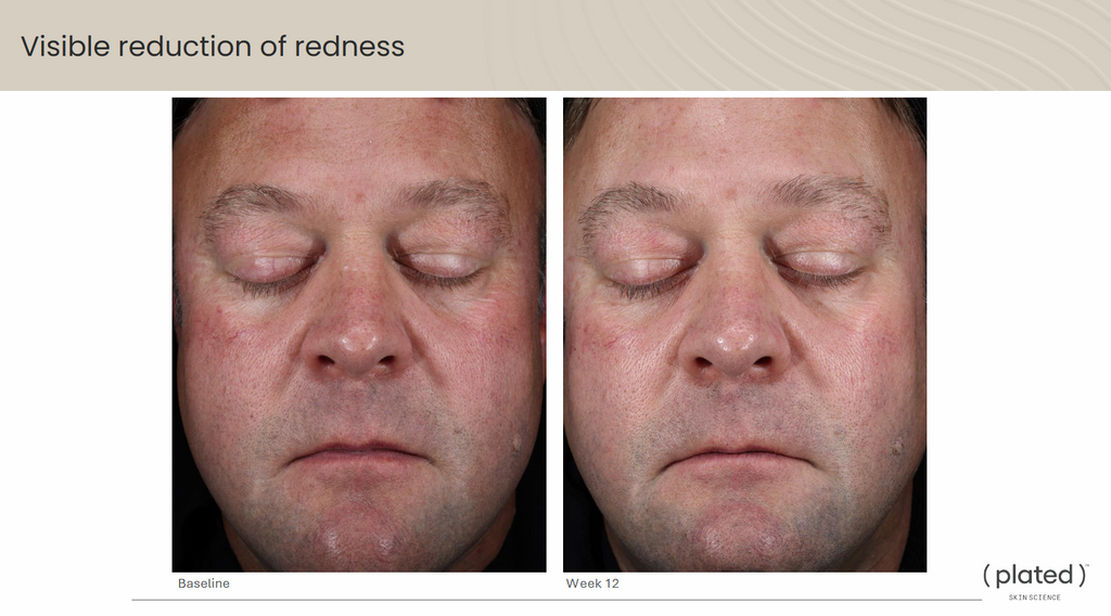 ( plated )™ Skin Science INTENSE Serum