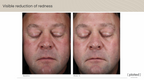 ( plated )™ Skin Science INTENSE Serum