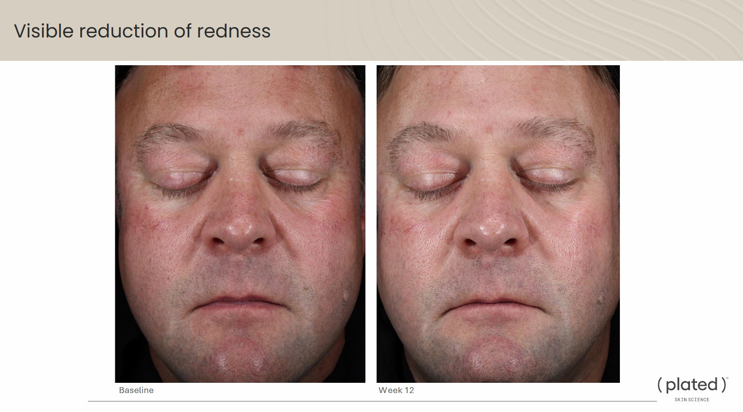 ( plated )™ Skin Science INTENSE Serum